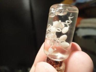 捐精？到底是羞于启齿还是助人为乐？女大学生的回答出人意料