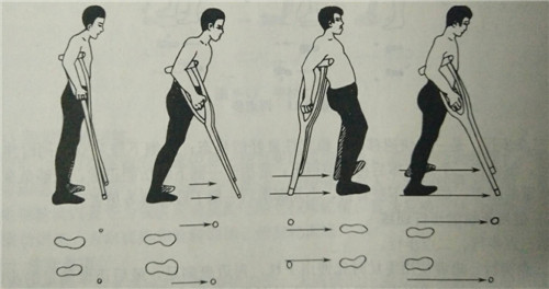 「专家支招」拐杖，你用对了吗？