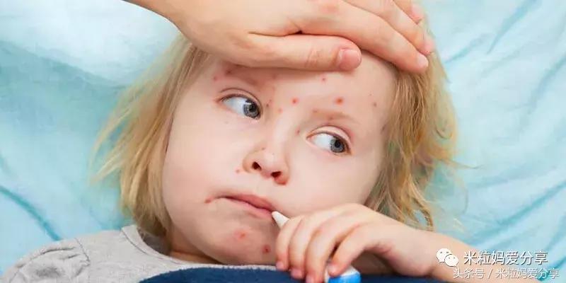 宝宝起疹的最佳治疗方法,孩子发烧后出疹怎么护理