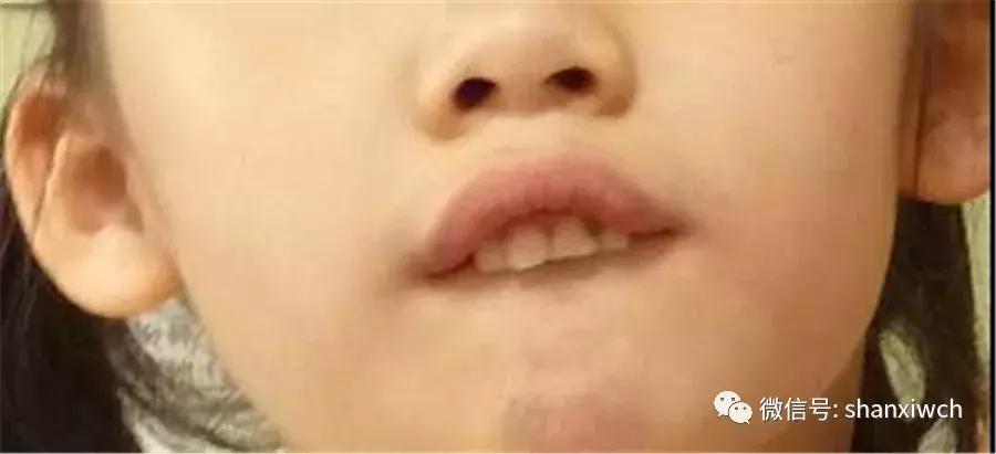 育儿知识关于牙齿,育儿知识幼儿牙齿敏感期