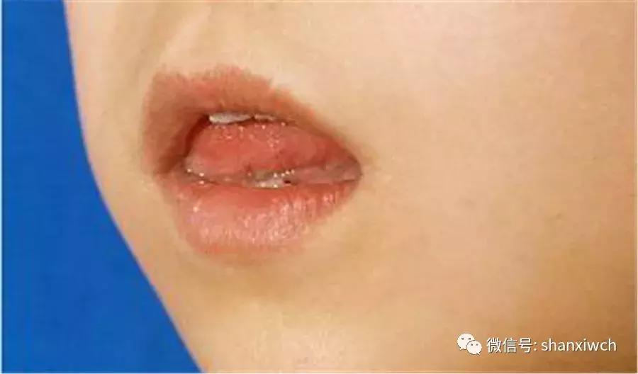 育儿知识关于牙齿,育儿知识幼儿牙齿敏感期