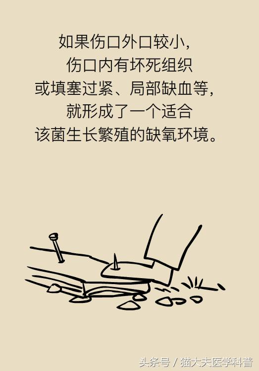 破伤风是破一点见风就会得吗,破伤风与伤口见风有关系吗