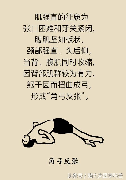 破伤风是破一点见风就会得吗,破伤风与伤口见风有关系吗