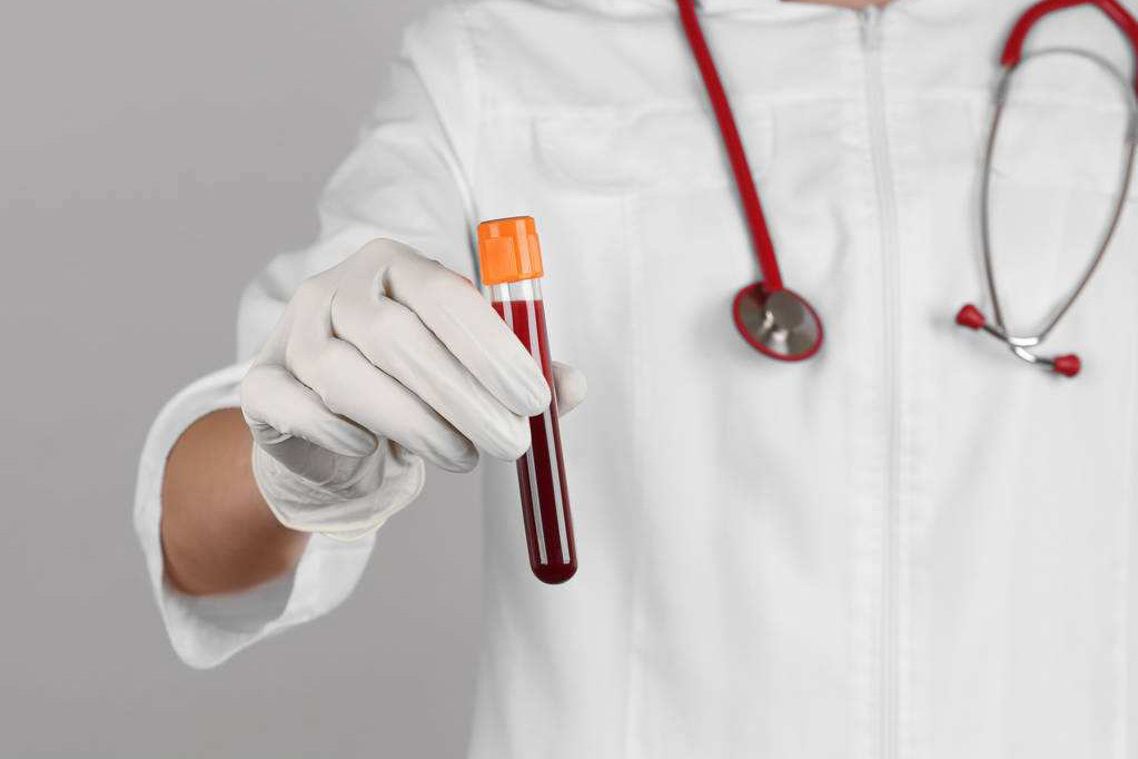 试管为啥要反复查雌激素,试管总是要抽血需要补血吗