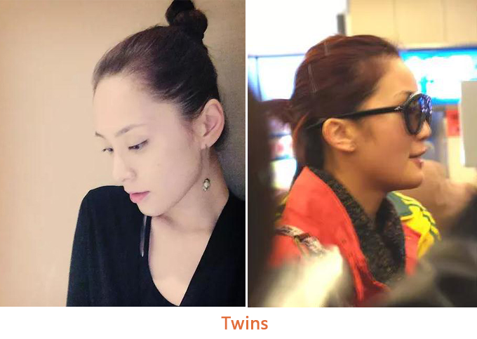 圆头扁头对颜值的影响,扁头对颜值的伤害