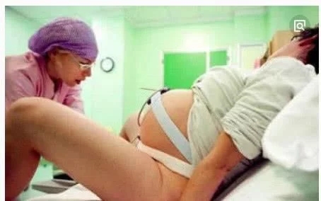 生孩子顺产需要挨刀吗,为什么顺产也要挨刀