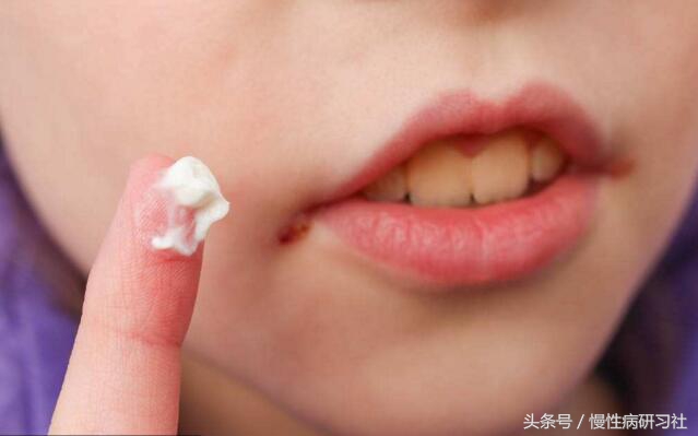 一个老人因信网上偏方治病致死,山东民间中医高手治皮肤病