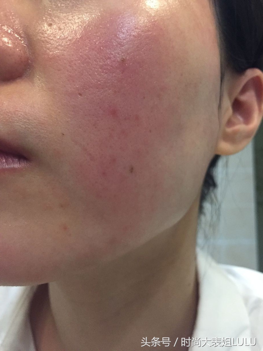 超好用的国货护肤品雅诗兰黛,十大护肤品sk2