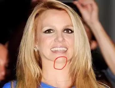 怎样化解双下巴,ps双下巴是怎么减下去的