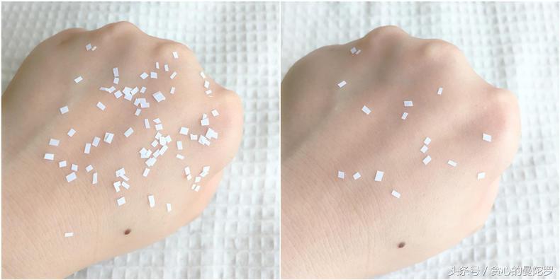 痘痘肌使用贝德玛爽肤水感受,贝德玛修护爽肤水