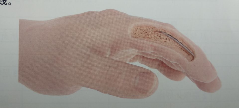 好用的美容美体手套,美容手套一次性耐用型