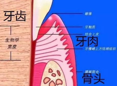 牙龈萎缩露出牙根还能恢复吗,牙龈萎缩牙齿根部会疼吗