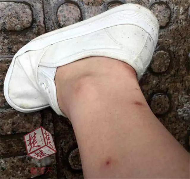 警惕猝死高发期,警惕年轻人接连猝死