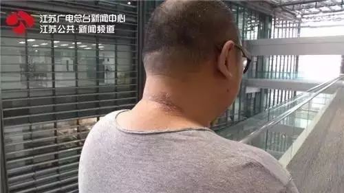 警惕猝死高发期,警惕年轻人接连猝死