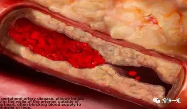 金泰妍露腹肌,金泰妍露腹