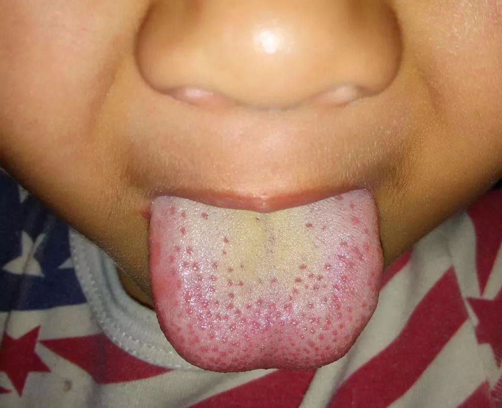 婴儿积滞推拿手法教程,宝宝积食小儿推拿教程完整版