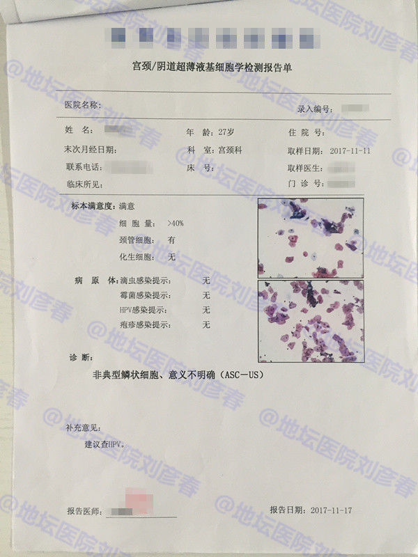 病例分享——27岁女性宫颈CIN3级病变并累及腺体，意味着什么？