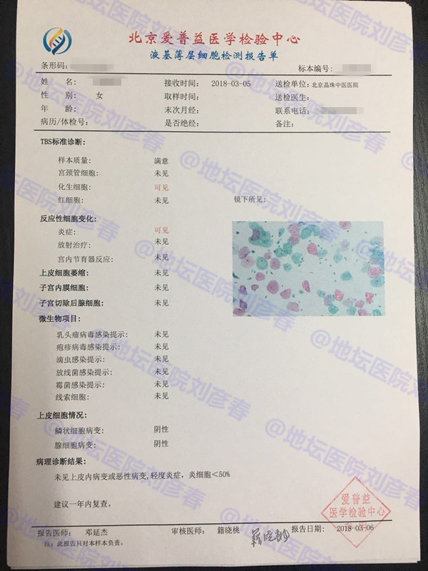 病例分享——27岁女性宫颈CIN3级病变并累及腺体，意味着什么？