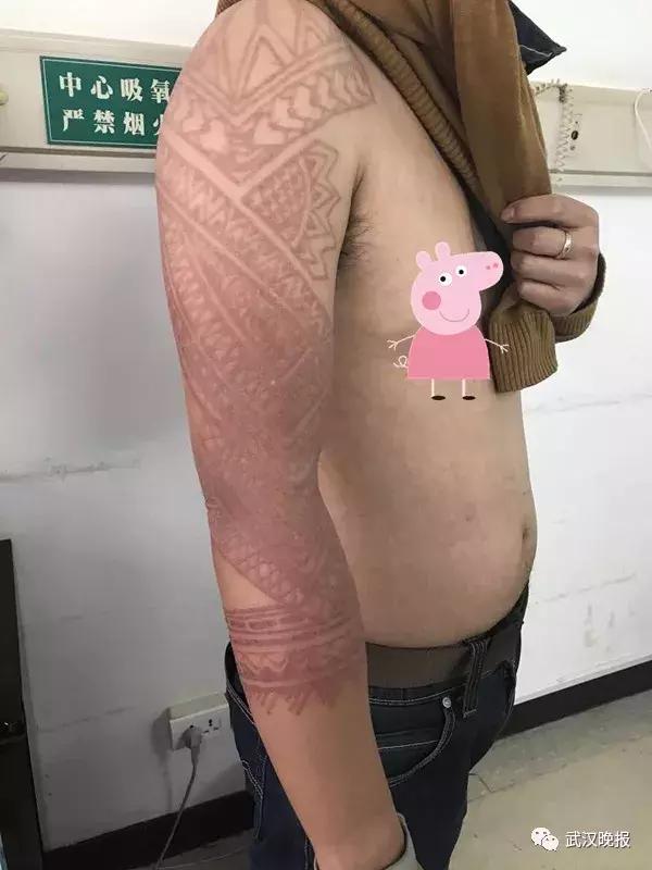 「健康」他在巴厘岛尝鲜特色服务，现在可能一辈子消不掉……悔恨啊！