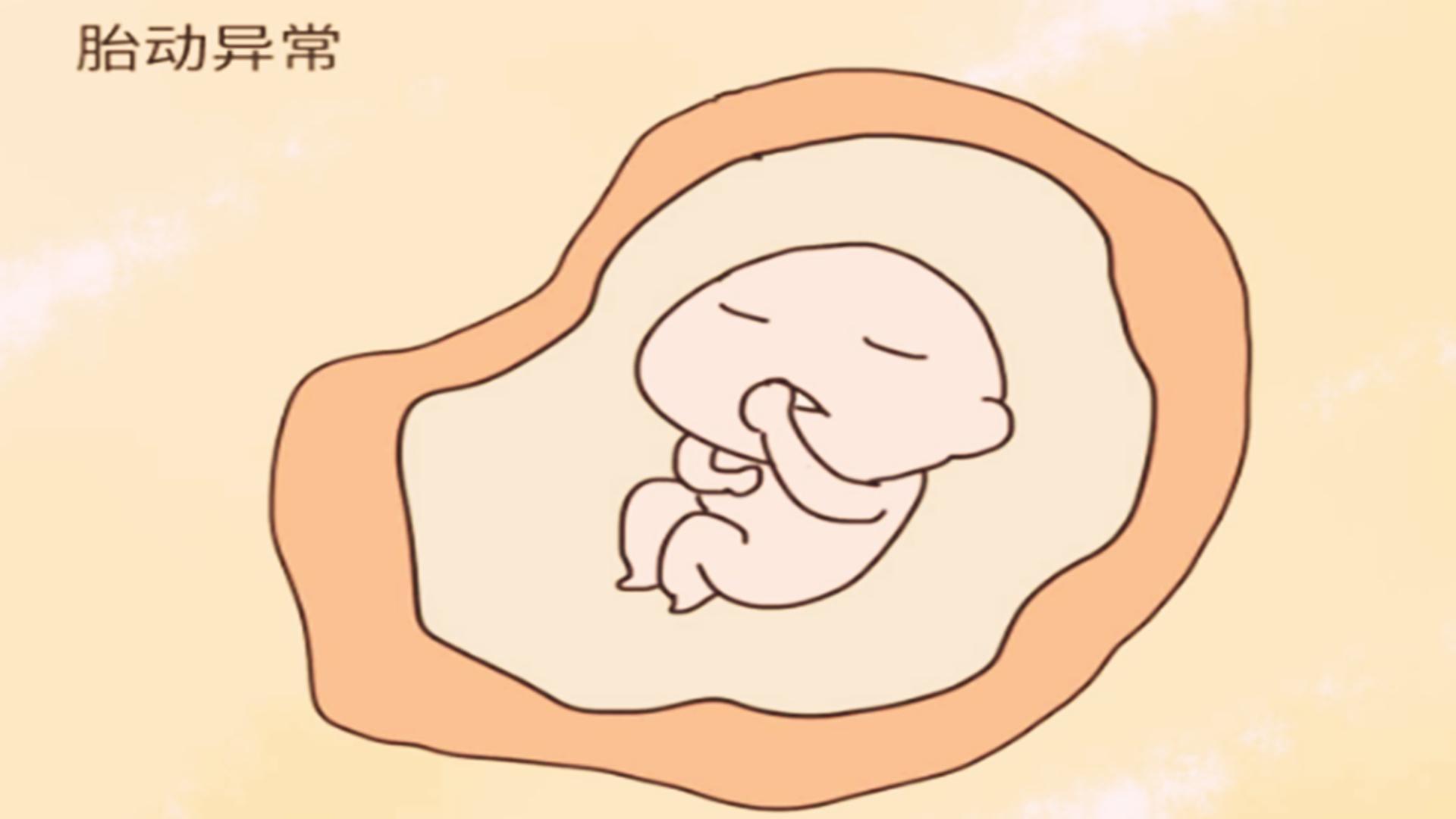 胎儿缺氧有信号,胎儿宫内缺氧孕妈有什么表现