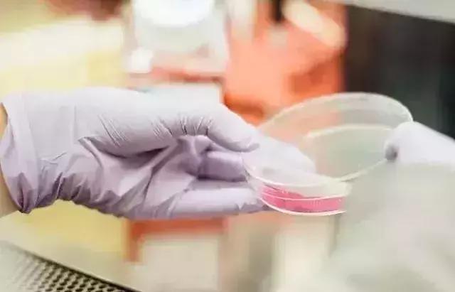 癌症是发炎引起的吗,炎症导致癌症6个原因