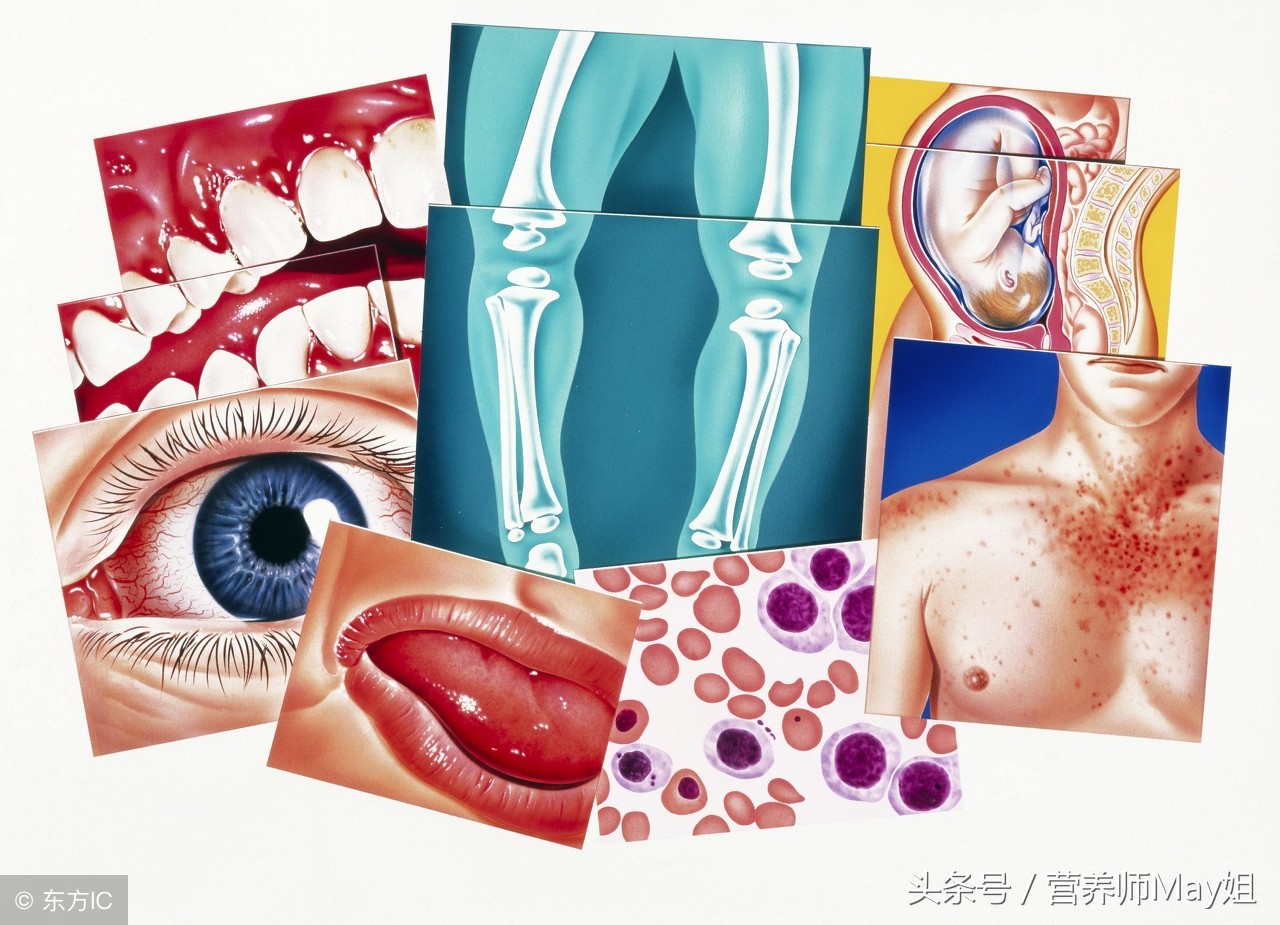 避开补钙五大误区如何有效补钙,补钙要讲究科学补过量会适得其反