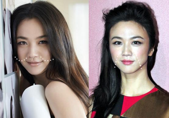 爱笑的女生如何避免法令纹加深,消除笑出来的法令纹最佳方法