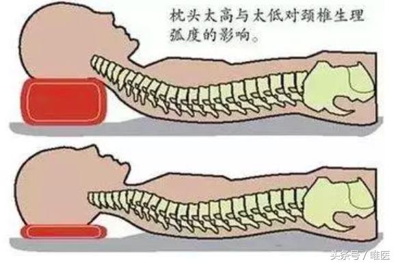 孩子颈椎不好推荐枕头,孩子头大颈椎不好怎么选枕头