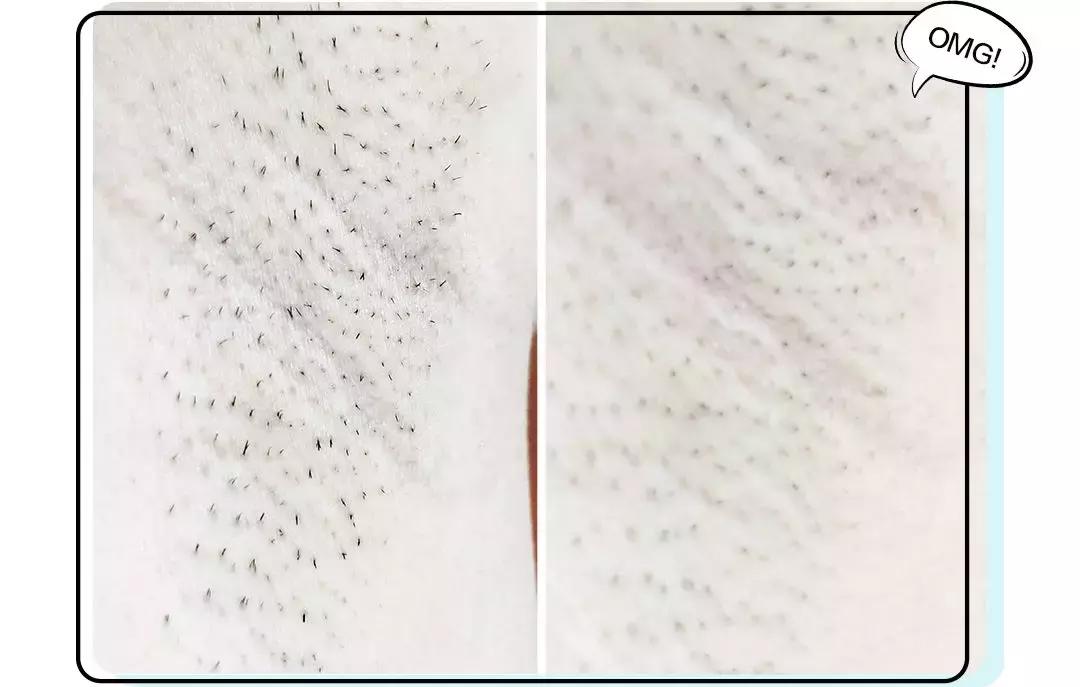 屈臣氏哪款脱毛膏最好,屈臣氏口碑最好的脱毛产品