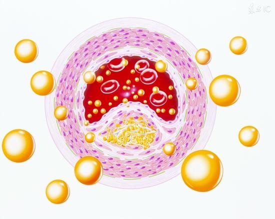 降血脂最好的方法,降血脂的方法和食谱