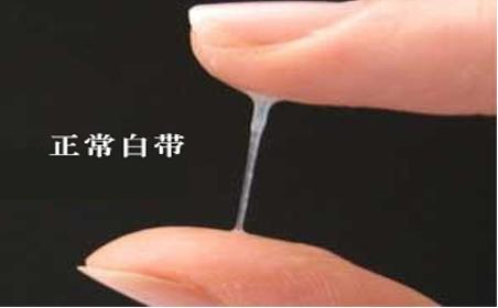 如果白带是黑色的怎么办,如果白带是黄的是什么原因