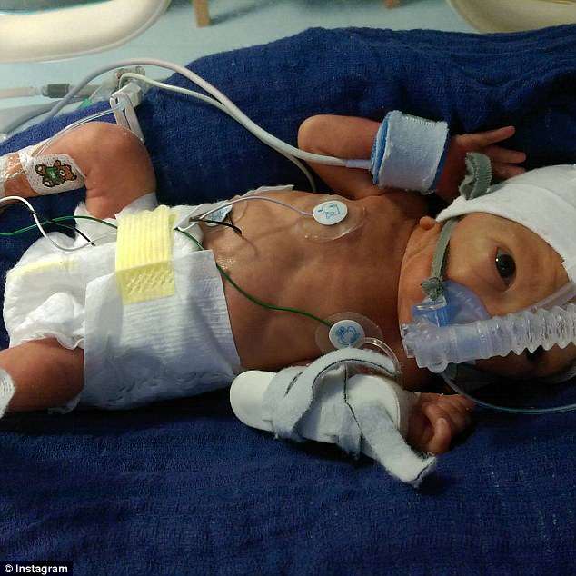 每天8杯水会中毒吗,每天8杯水200毫升