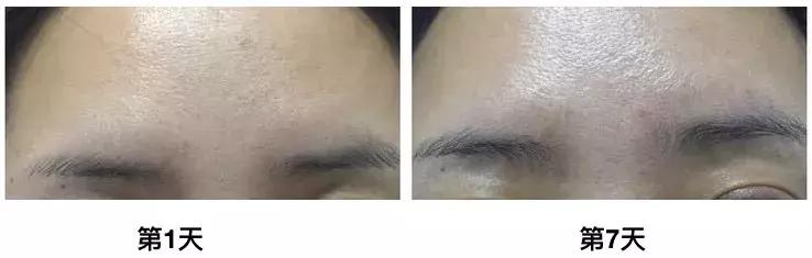 cosme精华推荐,cosme补水精华