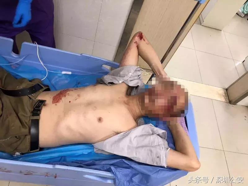 无证司机深夜撞人逃逸10小时后续,想跑没那么容易原版