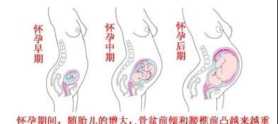 缓解产后腰痛的最佳办法,产后腰疼如何缓解宝妈们