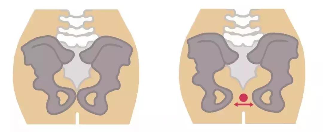 普林格尔产后康复仪有必要吗,产后康复有必要做么