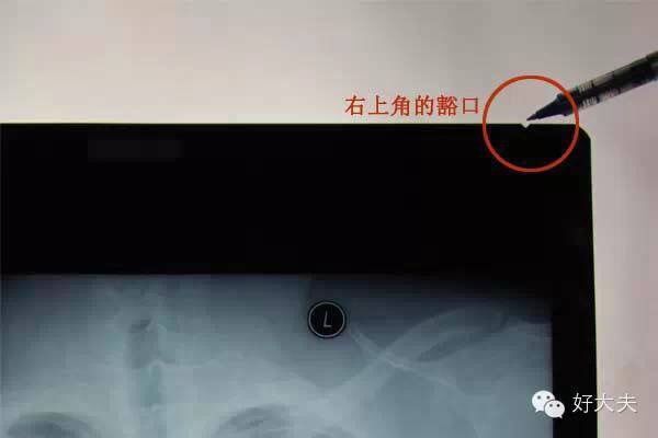 家里怎么拍片子给医生,如何把拍的ct片发给医生