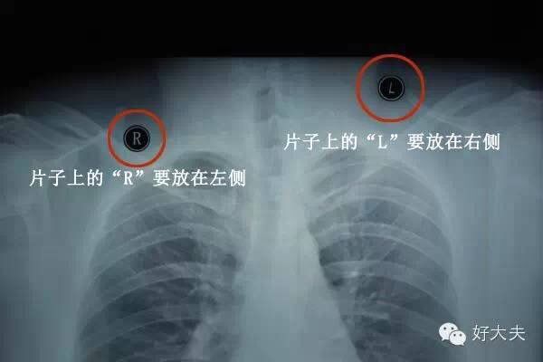 家里怎么拍片子给医生,如何把拍的ct片发给医生