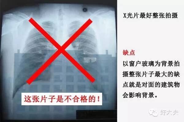 家里怎么拍片子给医生,如何把拍的ct片发给医生
