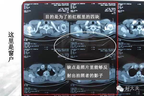 家里怎么拍片子给医生,如何把拍的ct片发给医生