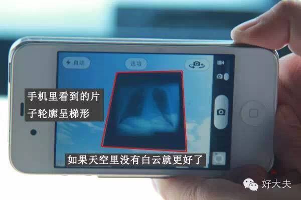 家里怎么拍片子给医生,如何把拍的ct片发给医生