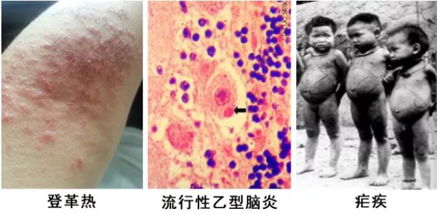 驱蚊喷雾妈妈专属,甜馨驱蚊液