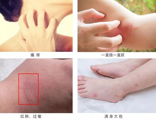 驱蚊喷雾妈妈专属,甜馨驱蚊液