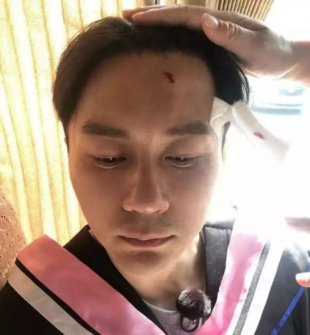 李晨受伤了吗,李晨受伤了怎么在医院里包扎