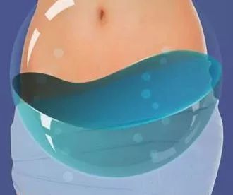 妇科b超腹部有积液是什么原因,妇科b超有积液