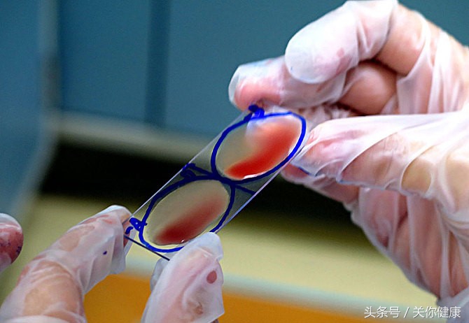 医院怎么看病看化验单,去医院检查怕花钱怎么办