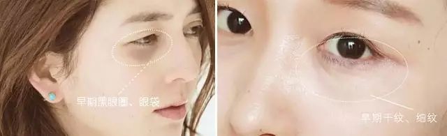 日常推荐一款超好用的眼膜,超级效果好又好用的眼膜