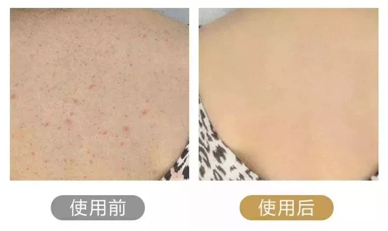 别让垃圾堵塞你的毛孔！有了这款火爆日本的沐浴刷，让你惊呼：洗澡搓背原来这么爽