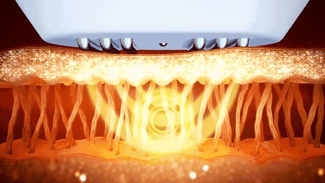 洁面脱毛仪,洁面脱毛仪测评