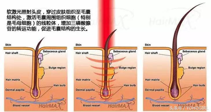 洁面脱毛仪,洁面脱毛仪测评